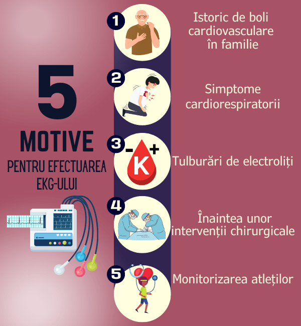 Electrocardiograma